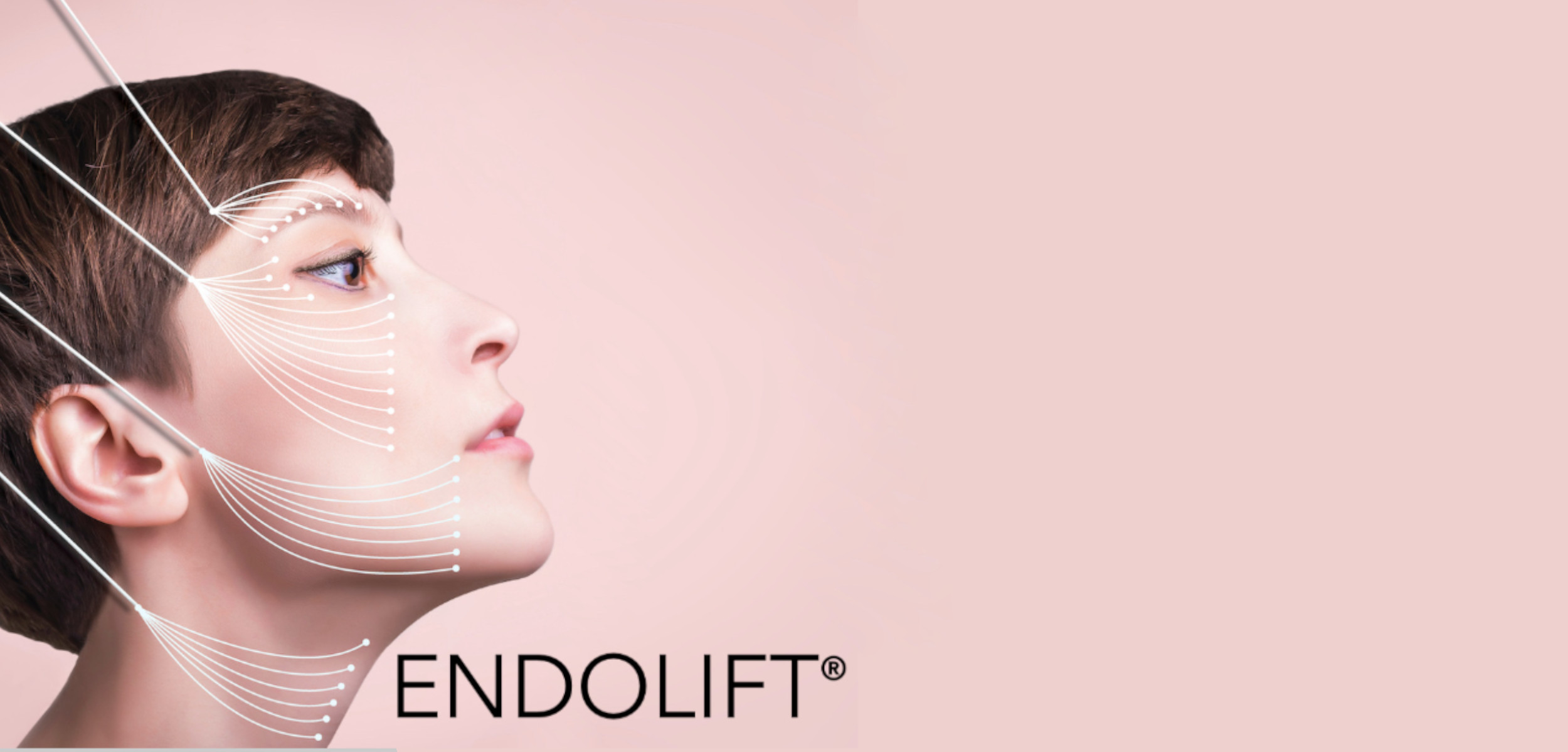 ENDOLIFT – traitement non chirurgical